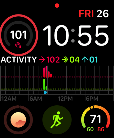 I Can T Has Cheezburger Live Ish Glucose Data On Apple Watch